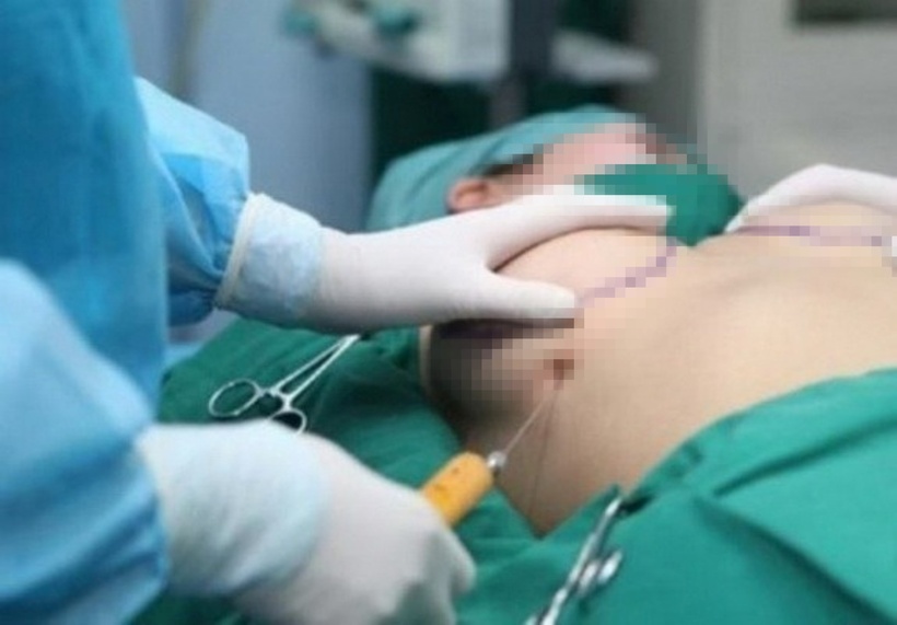 Việc làm ngực ở nơi không uy tín tiềm ẩn nhiều nguy cơ biến chứng. Ảnh: Sức khỏe & Đời sống/minh họa.