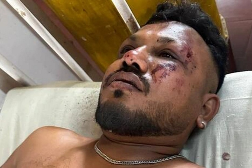 Ramesh Viswashkumar - nam hành khách thoát chết sau vụ tai nạn máy bay chở 242 người.  Ảnh: Hindustan Times.