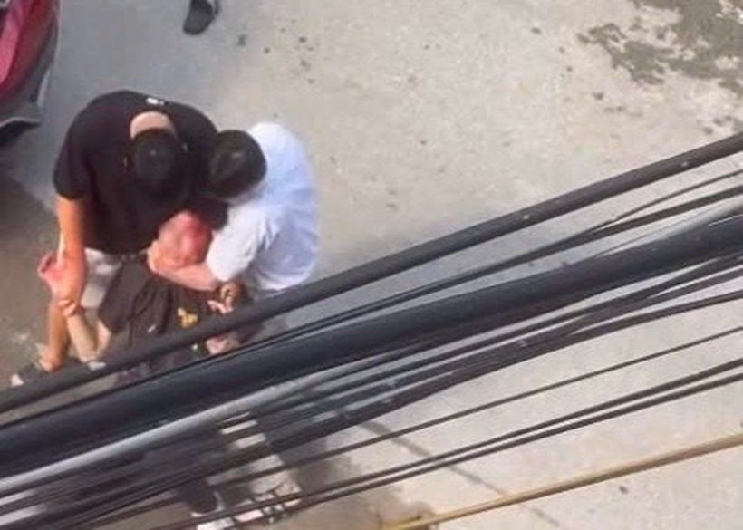 Nam thanh niên bị 2 bố con đi ô tô "tác động". Ảnh: Công lý