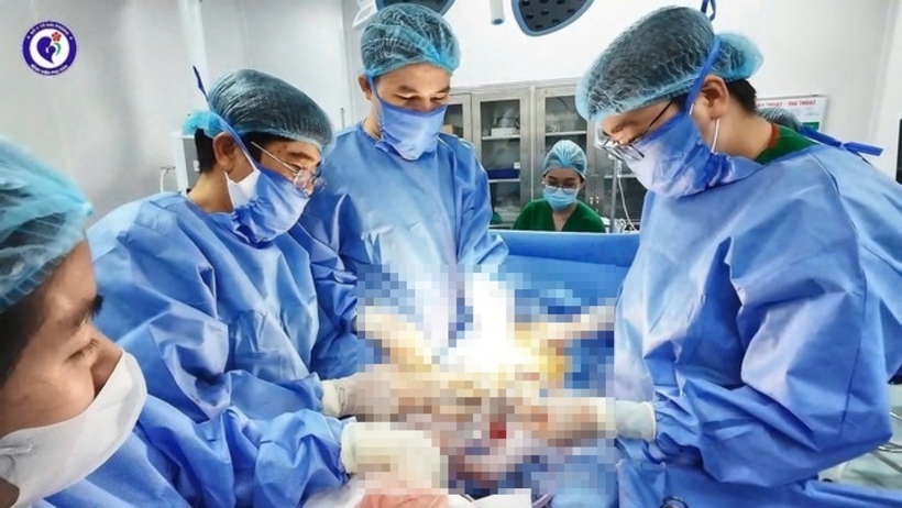 Các bác sĩ thực hiện ca mổ. Ảnh: Sức Khỏe & Đời Sống
