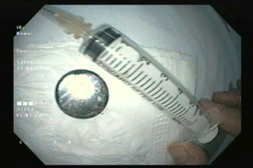 Pin cúc đã bị oxy hóa, đường kính gần 2cm. Ảnh: Báo Công lý.