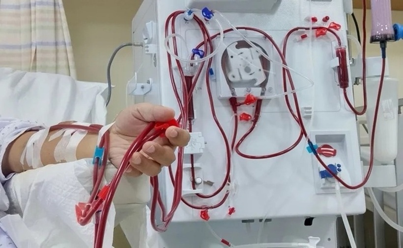 Hệ thống lọc máu được áp dụng cho bệnh nhân chạy thận. (Ảnh: VTC News)