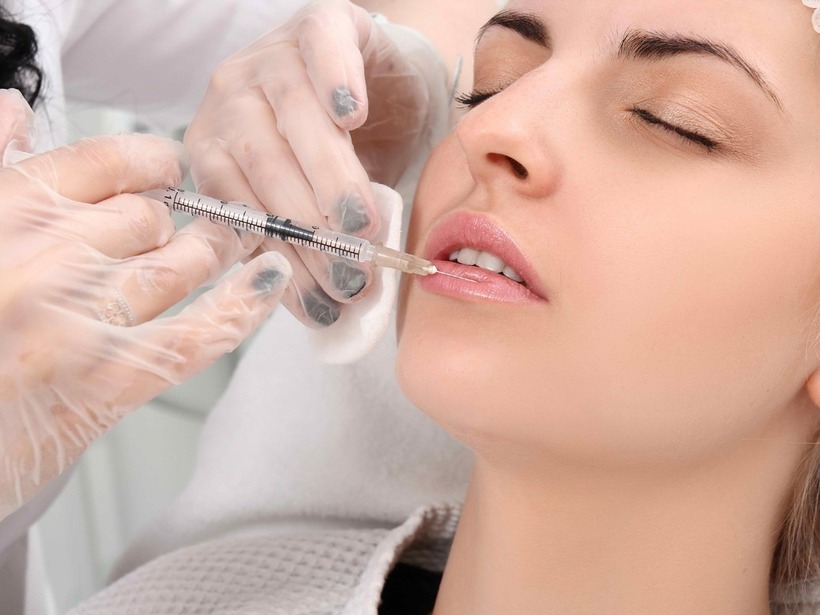 Một người được tiêm filler. Ảnh minh họa