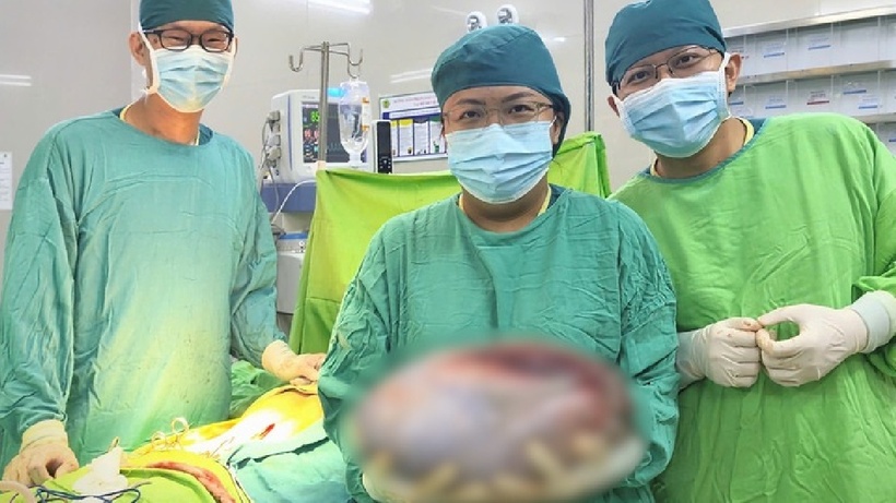 Khối u kích thước khoảng 30 x 40 cm, nặng gần 8kg. Ảnh: VTC News.