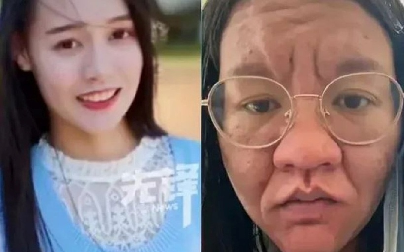 Đến tháng thứ 6 và thứ 9, Li trải qua nhiều biến đổi thể chất nghiêm trọng hơn. Ảnh: Người đưa tin.