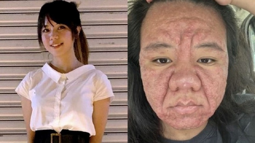 Farah gây chú ý khi bỗng nhiên "biến" thành một bà lão 60 tuổi chỉ sau vài tháng mang thai. Ảnh: HK01.