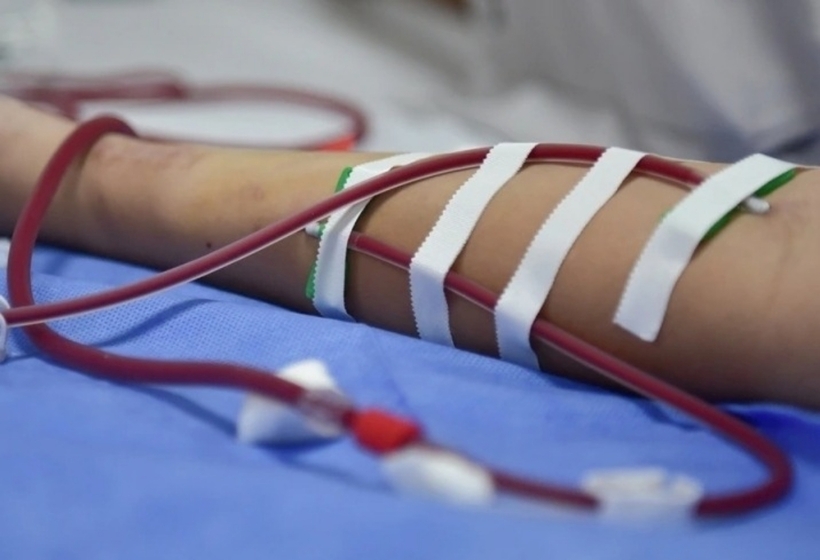 Bệnh thận mạn không thể chữa khỏi hoàn toàn, khi suy đến giai đoạn cuối, người bệnh buộc phải sống phụ thuộc vào máy lọc máu hoặc chờ ghép thận. Ảnh minh họa: VTC News