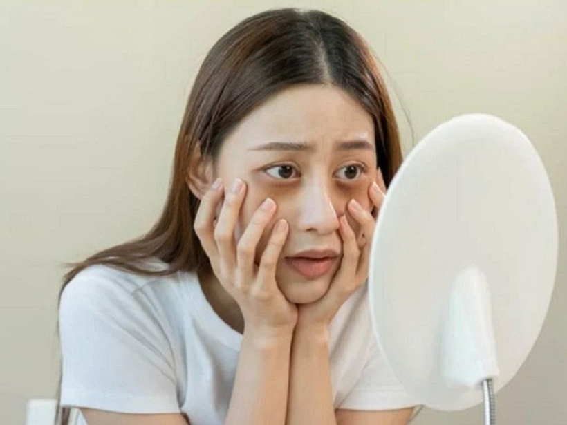 Ở vùng dưới mắt có 2 thứ phản ánh sức khỏe của thận là bọng mắt và vùng da ngay dưới bọng mắt.