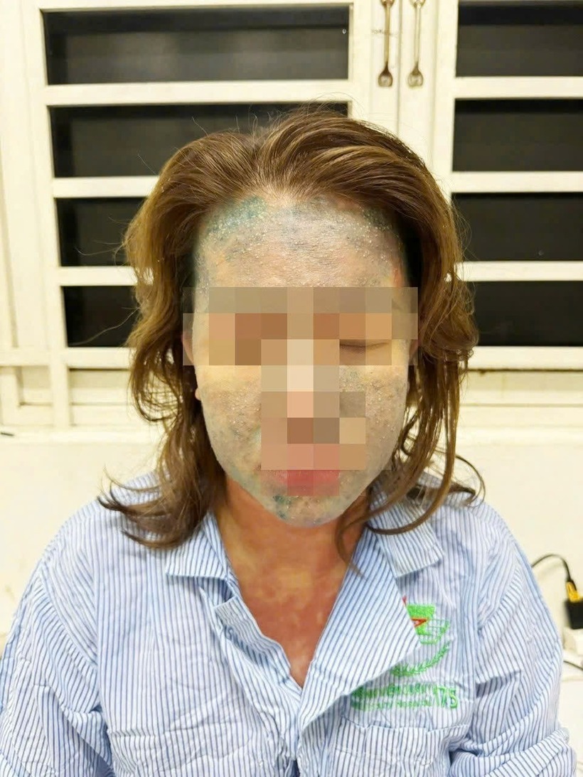 Người phụ nữ nguy kịch sau khi dùng thuốc giảm cân thải độc, collagen "trôi nổi". Ảnh: Báo Xây dựng.