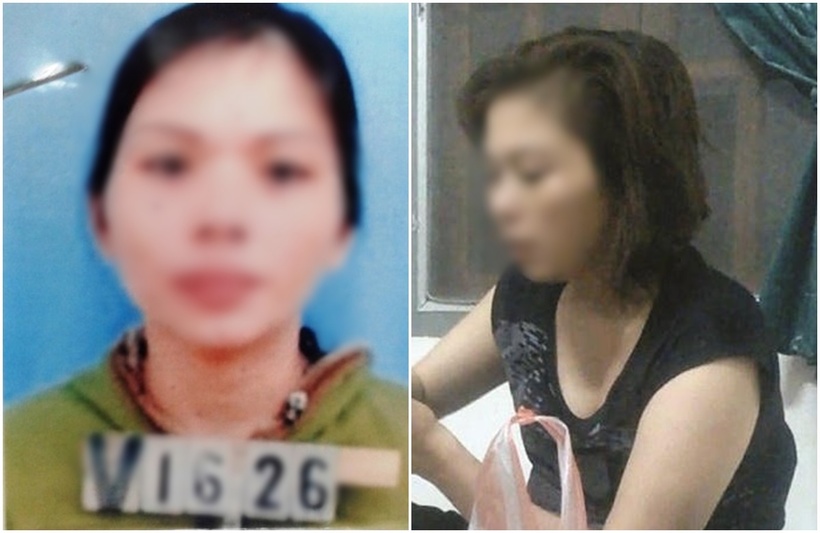 Thảo trước và sau khi phẫu thuật thẩm mỹ.