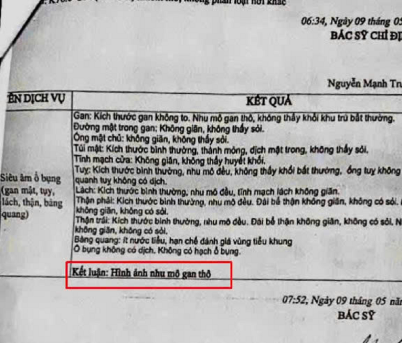 Từ xơ gan F4 đến hồi phục kỳ diệu nhờ Y học tái tạo: Hành trình sống lại của người phụ nữ 66 tuổi - 2