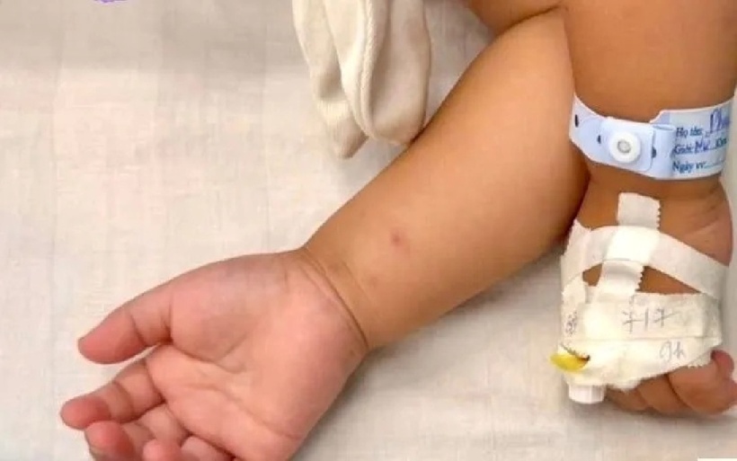 Bé gái 2 tuổi nhập viện khẩn cấp vì uống nhầm loại thuốc đóng gói như kẹo thạch. Ảnh: VTV.