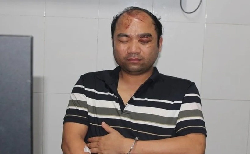 Trần Hữu Ba tại cơ quan công an. (Ảnh: Công an)