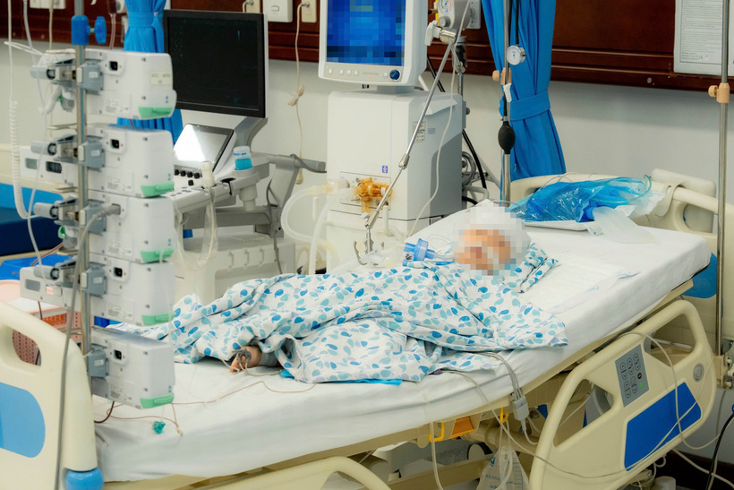 Bệnh nhi 4 tuổi vẫn phải thở máy kiểm sóat chức năng sống. Ảnh: BVCC