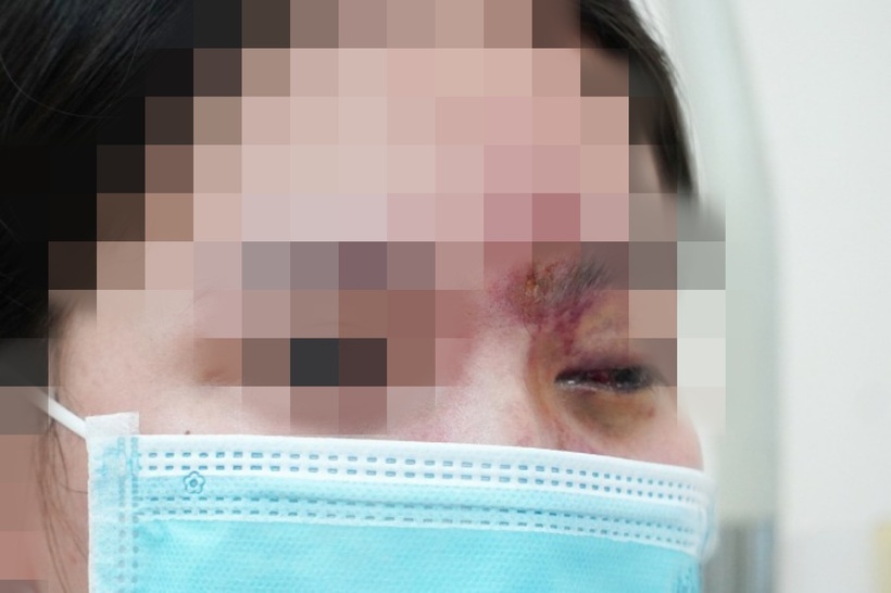 cô gái trẻ thời điểm nhập viện. Ảnh: VnExpress