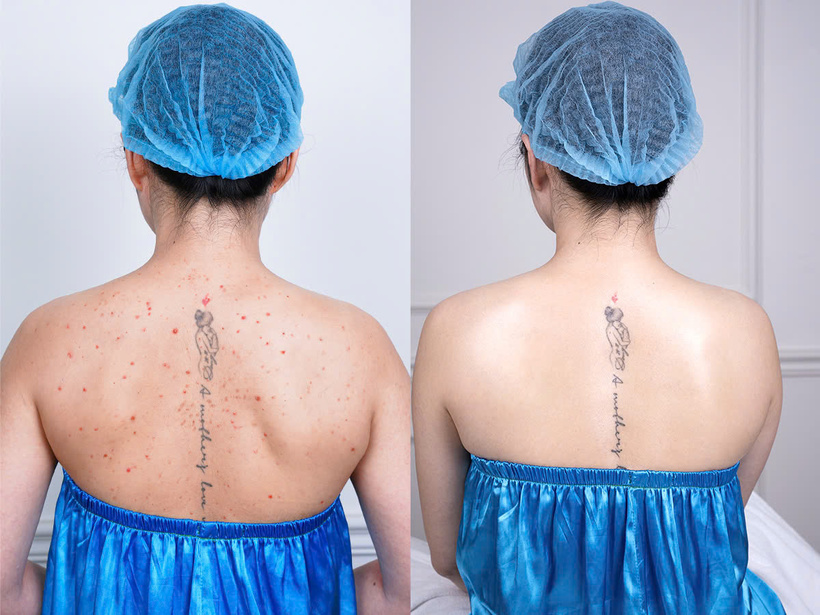 BS.CKI Nguyễn Ngọc Minh và hành trình 10 năm chữa lành cho hàng nghìn bệnh nhân viêm nang lông - 4