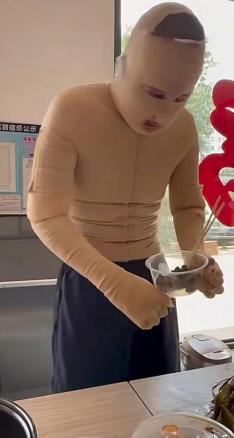 Du bị bỏng nặng, tổn thương nghiêm trọng. Du bị bỏng nặng, tổn thương nghiêm trọng.