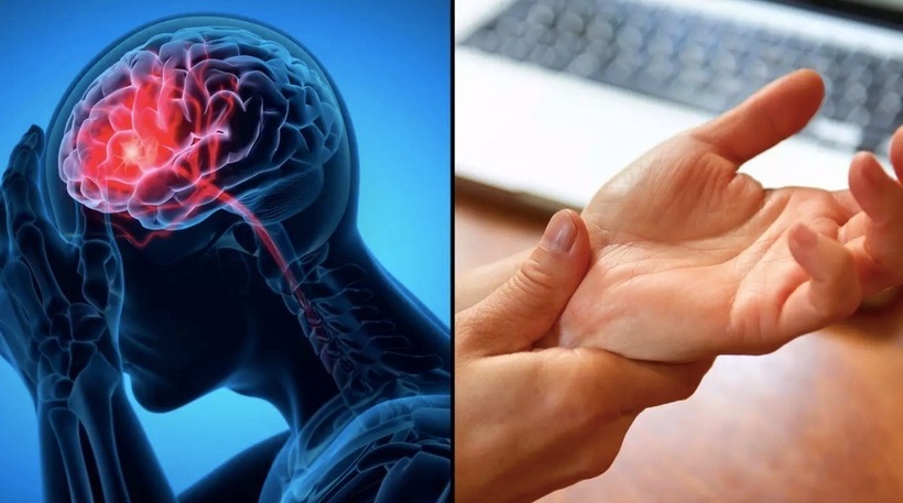 Dấu hiệu cảnh báo đột quỵ trước một tuần tuyệt đối đừng bỏ qua! - 1