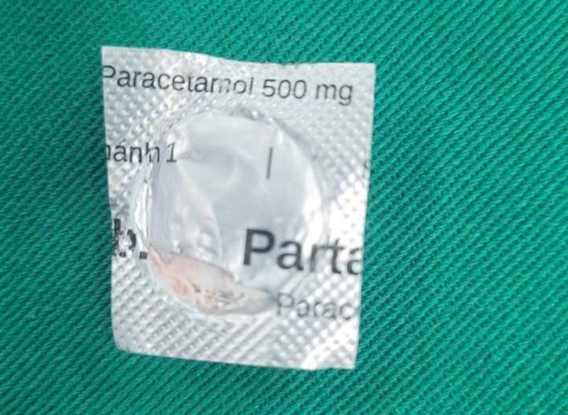 Dị vật là viên thuốc còn nguyên vỏ được gắp ra. Ảnh: Sức Khỏe & Đời Sống