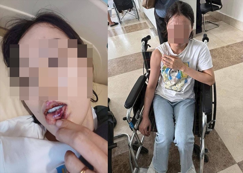 Nạn nhân C. bị thương sau sự việc. Ảnh: VietNamnet