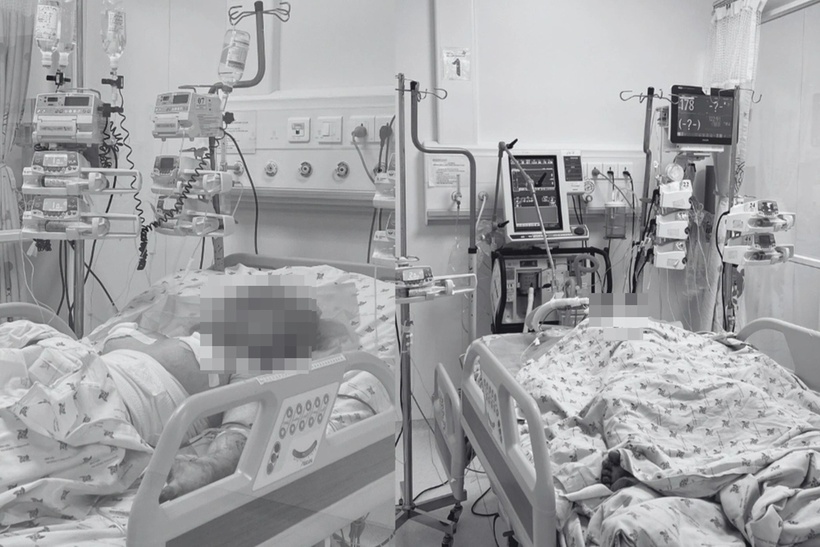 Hai cháu bé bỏng nặng đang được điều trị tích cực. Ảnh: Dân trí