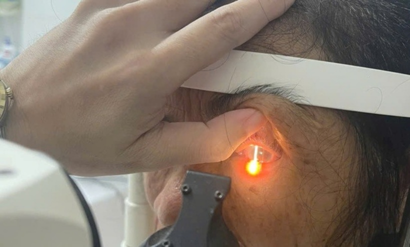 Tin theo mẹo dân gian dùng rượu ngâm hạt na trị chấy, một phụ nữ ở Hà Tĩnh đã phải nhập viện do bị bỏng mắt, đối mặt với nguy cơ mất thị lực. Ảnh: Sức khỏe & Đời sống.
