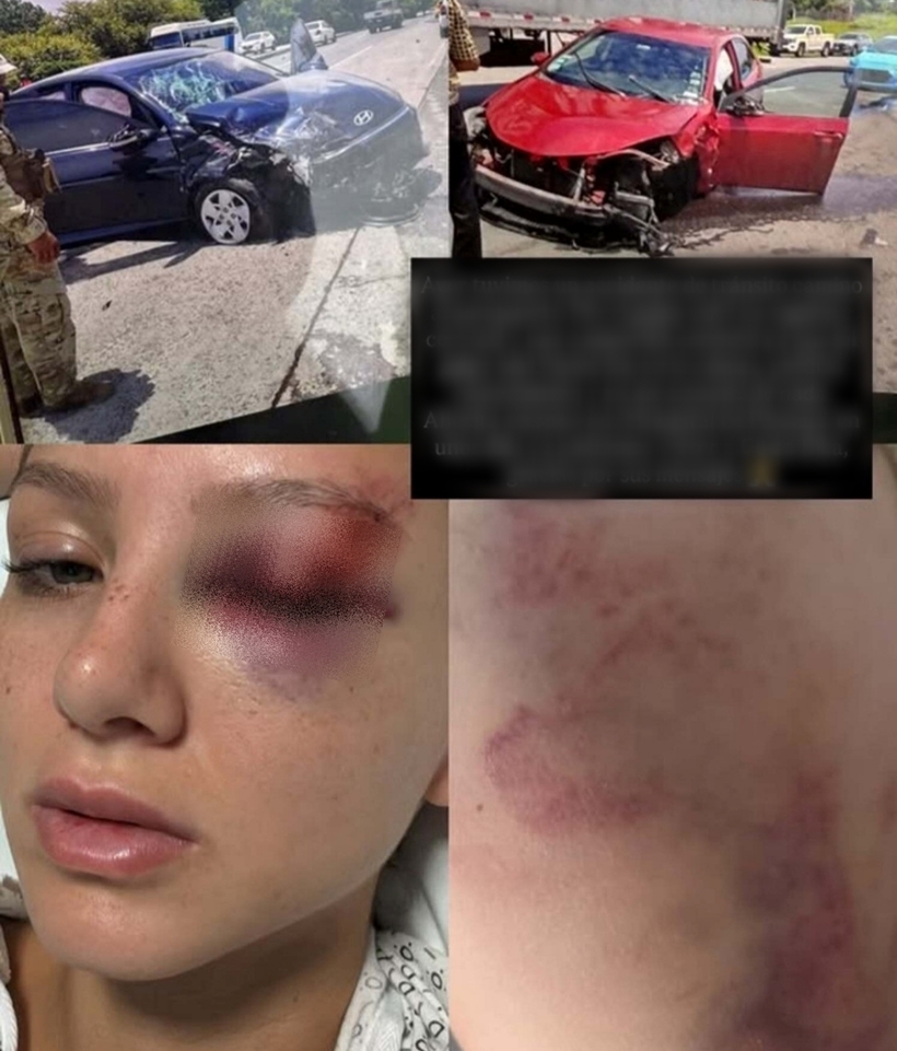 Hình ảnh về vụ tai nạn do Hoa hậu Camille chia sẻ.