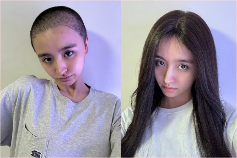 Nữ ca sĩ cạo trọc đầu, ngoại hình gầy gò và ánh mắt buồn bã. Ảnh: Xiaohongsu