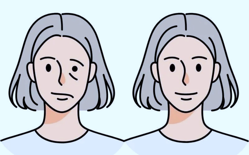 Người dân đừng chủ quan khi có những biểu hiện như méo miệng, khó cười, uống nước chảy, nhắm mắt không kín, gương mặt thiếu cảm xúc một bên. Ảnh minh họa: Alpha Vector