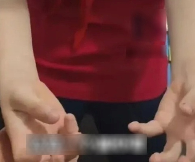 Cường độ học tập quá nặng nề khiến Tiểu Phi co giật hàng chục lần mỗi ngày. Ảnh minh họa.