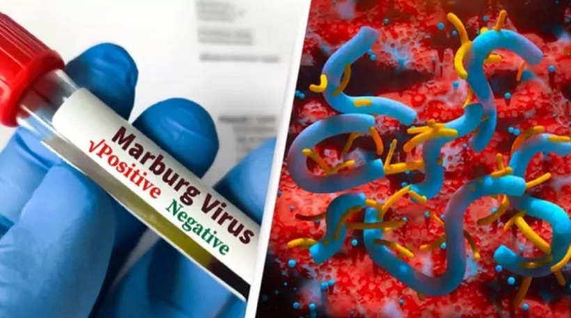 Virus Marburg (MVD). Ảnh: Unilad