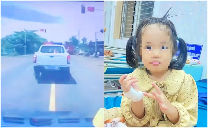 Cháu N.D.P.A đã thoát khỏi nguy hiểm nhờ được cấp cứu kịp thời. (Ảnh: PLO)