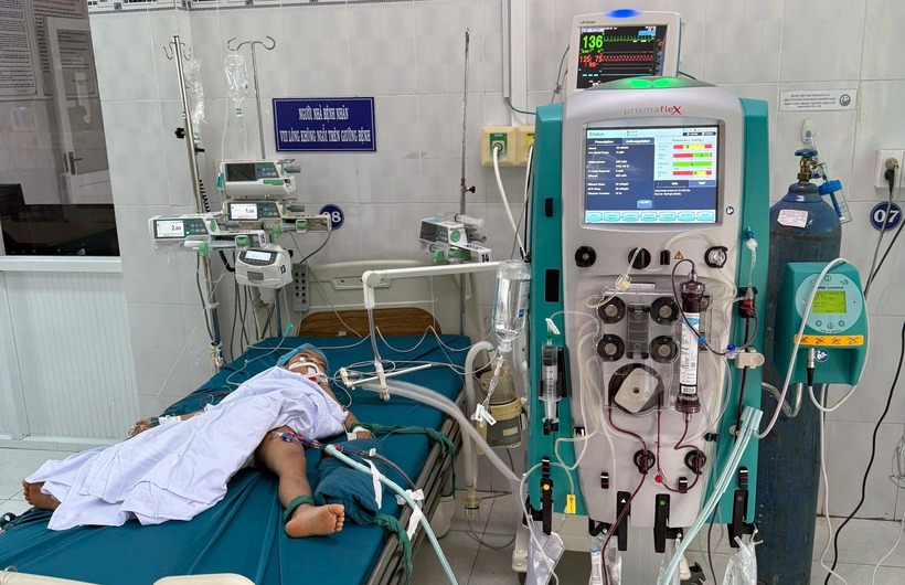 Bị ong vò vẽ cắn, cháu A.T được chẩn đoán nhiễm độc độ 3, đang phải lọc máu liên tục để loại bỏ độc tố. (Ảnh: Thanh niên)