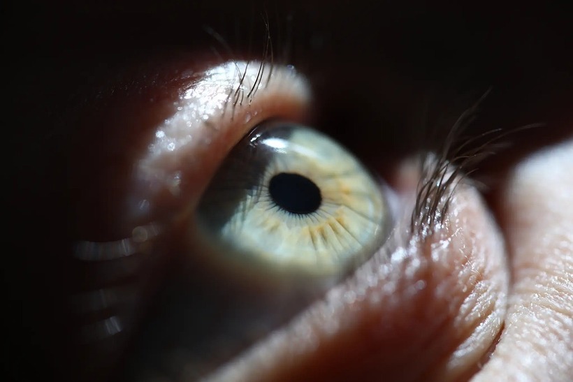 Ca phẫu thuật cấy răng vào mắt đã giúp nhiều người mù lòa có lại được ánh sáng. Ảnh: Adobe Stock