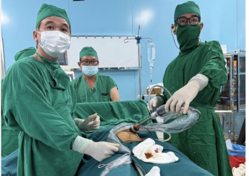 TS-BS Huỳnh Giang Châu (Bệnh viện Hùng Vương), BS Văn Phước Toàn (Bệnh viện Bình Dân) đã cùng các y, bác sĩ Trung tâm Y tế Quân dân y Côn Đảo phối hợp thành công phẫu thuật nội soi cắt bướu quái buồng trứng cho một nữ bệnh nhân ngay tại Côn Đảo. Ảnh: NLĐ.