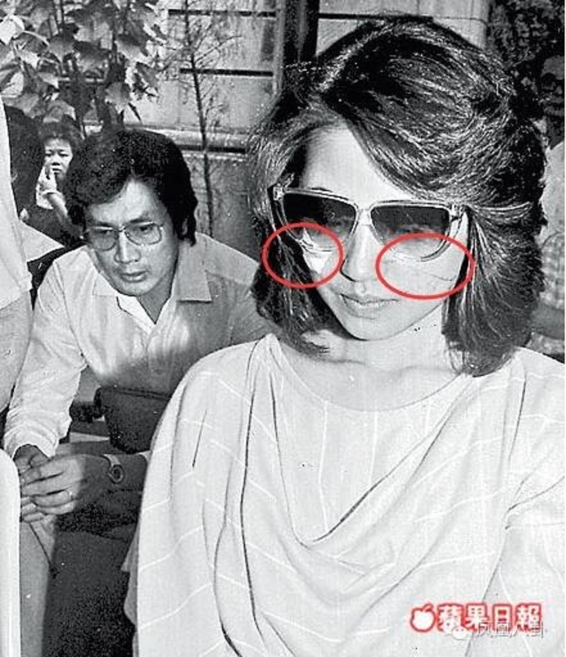 Khuôn mặt chằng chịt vết thương của Đới Lương Thuần.