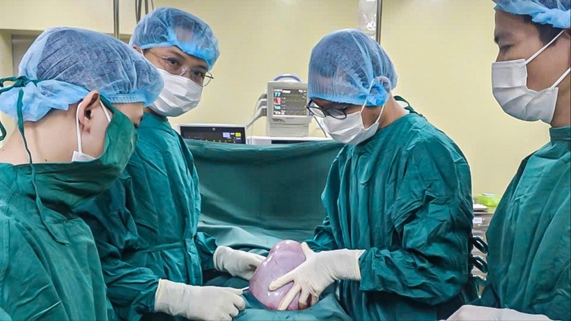 Ê kíp bác sĩ lấy khối u nặng 5,5 kg từ nữ bệnh nhân. Ảnh: Thanh Niên.