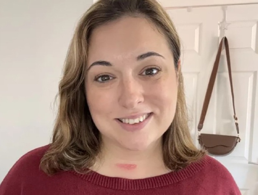 Hayley Black, 36 tuổi bị gãy hai đốt sống cổ, liệt nửa người sau khi ngáp và vươn vai. Ảnh: Kennedy Newsand Media.