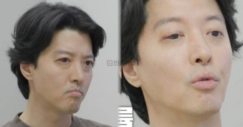 Lee Dong Gun được chẩn đoán mắc viêm cột sống dính khớp (AS)