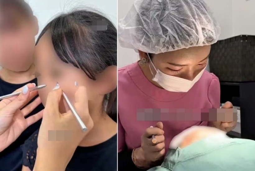 Video cắt mí cho bé gái tiểu học gây phẫn nộ.  Ảnh chụp màn hình: Weekly Women's Prime.