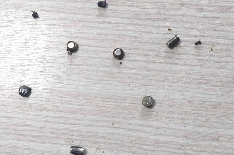 Dị vật được lấy ra từ ruột của bé H. Ảnh: Dân Trí.