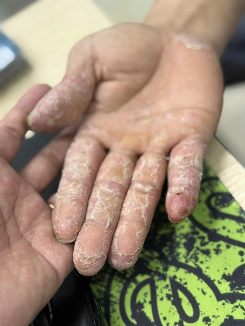 Môi trường ẩm ướt sau lũ là điều kiện lý tưởng để vi khuẩn, nấm mốc sinh sôi (Ảnh: BSCC).