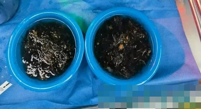 Lượng tóc thu được đủ để lấp đầy hai chậu lớn. Ảnh: Saostar.