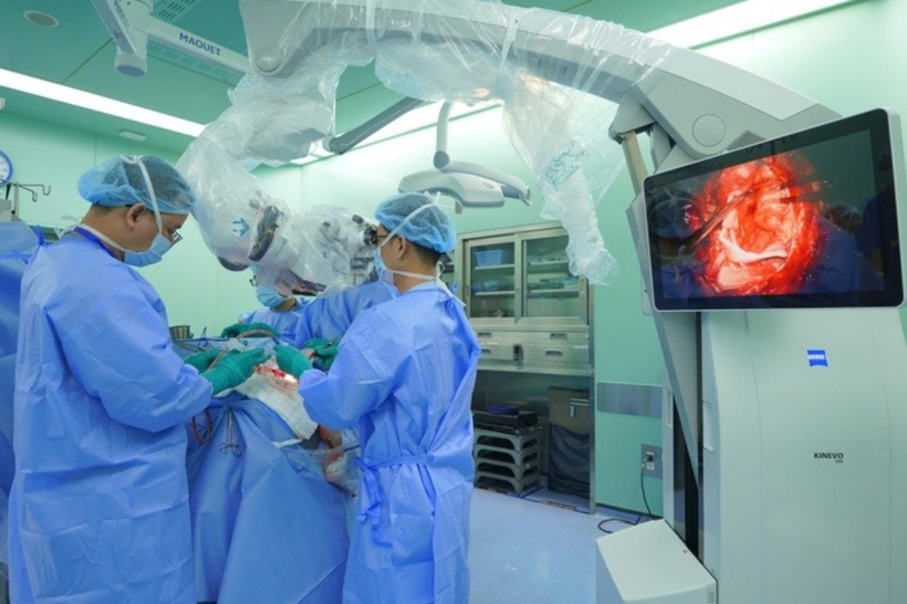 TS-BS Trương Thanh Tình, Trưởng Khoa Ngoại Thần kinh - Bệnh viện Đại học Y Dược TP. HCM và các bác sĩ phẫu thuật não bằng kính vi phẫu. Ảnh: Người lao động.