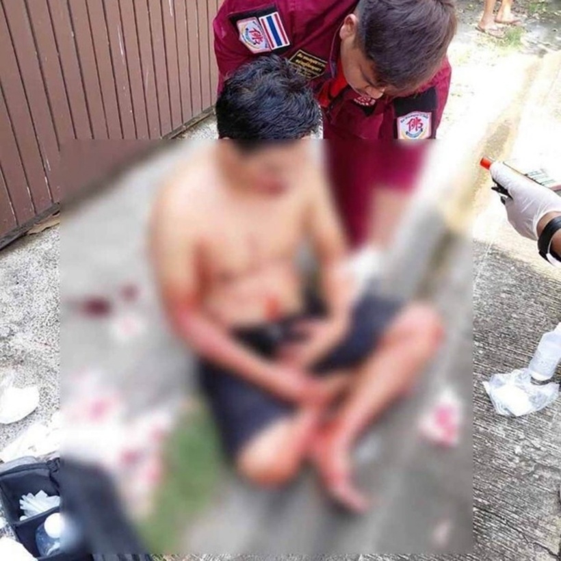 Nghi phạm bị thương. Ảnh: KhaoSod