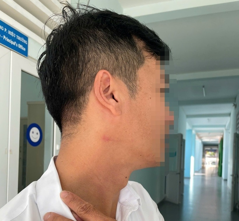 Thầy giáo bị đau và có dấu hiệu tổn thương vùng cổ sau khi bị đồng nghiệp hành hung. Ảnh: Tiền phong
