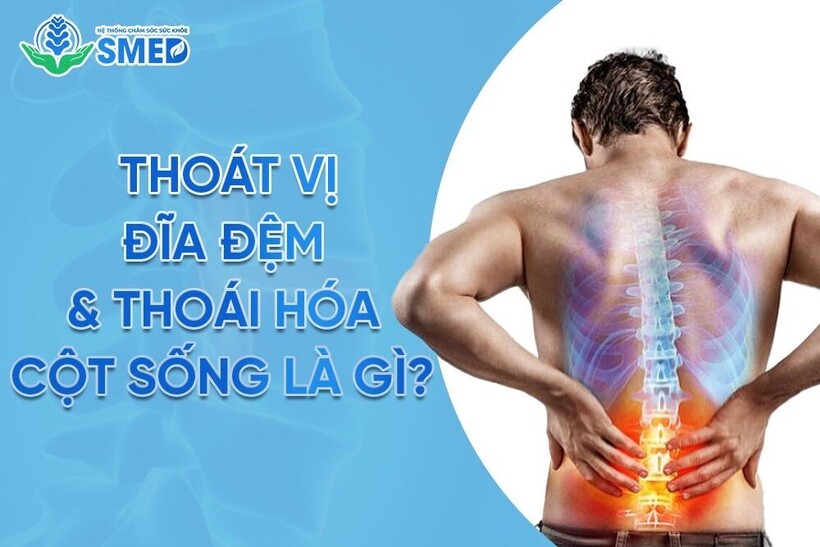 Bệnh lý thoát vị đĩa đệm và thoái hóa cột sống