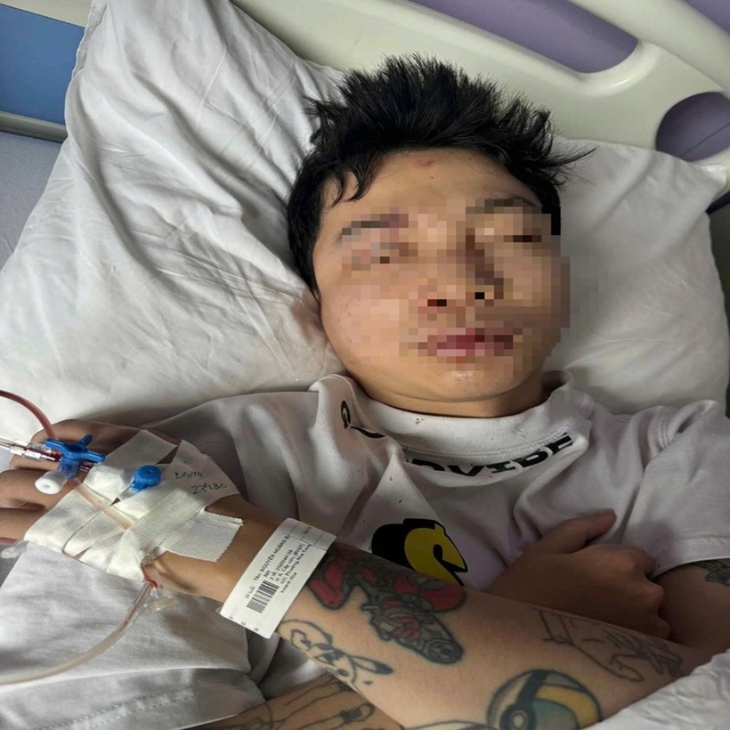 Nam DJ trẻ bị hành hung ở Huế phải nhập viện điều trị. (Ảnh: Tuổi trẻ)