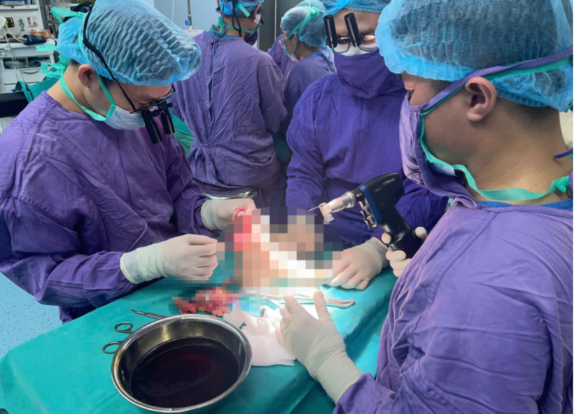 Ê kíp bác sĩ thực hiện ca phẫu thuật cho bệnh nhân. Ảnh: VietNamNet.