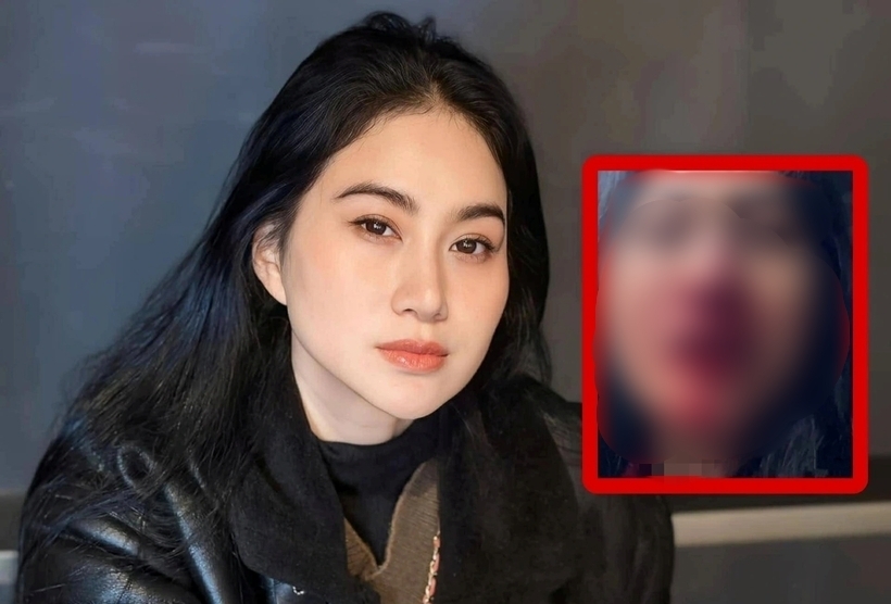 Hình ảnh của Phi Ngọc Ánh trên livestream gây hoang mang. Ảnh: Thanh Niên